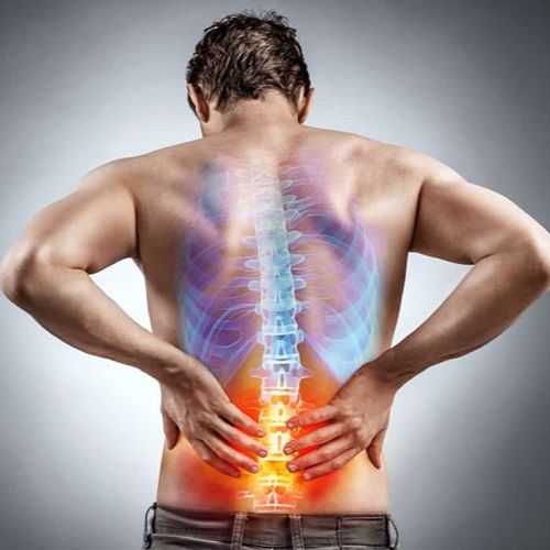 How to Relieve Back Pain at Home